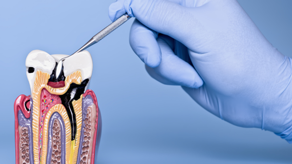 Reverse Early Gum Disease Before It Worsens
