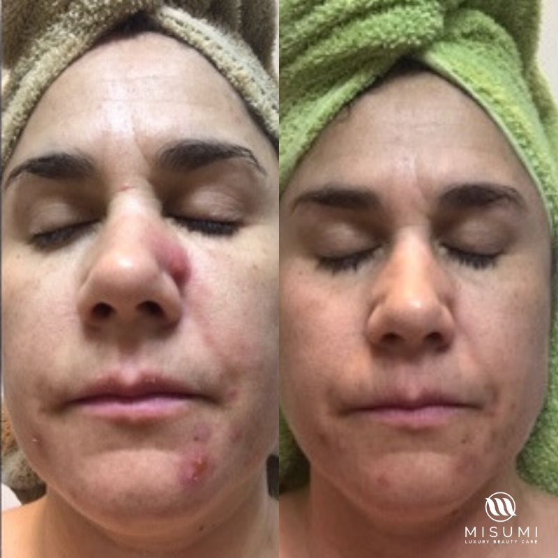 Clear Skin Salicylic Cleanser