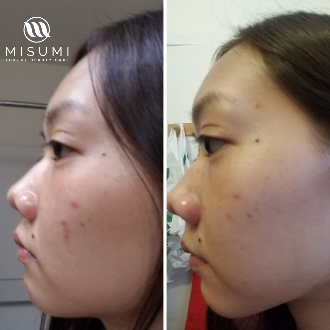 Pore Purifying Toner