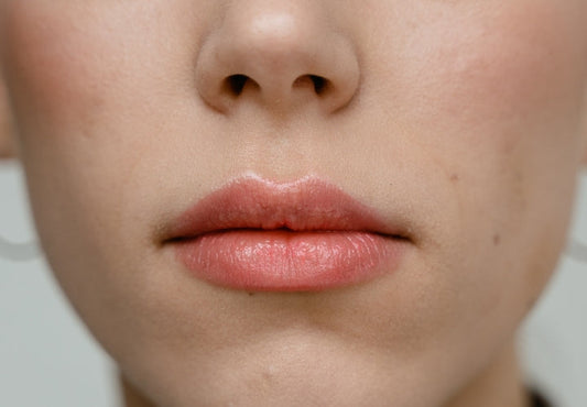 5 Home Remedies To Get Rid Of Bumps After Waxing