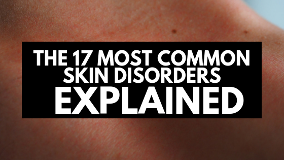 The 17 Most Common Skin Disorders Explained