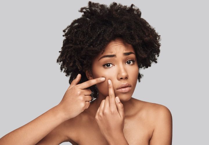 Best Cystic Acne Treatments: Say Goodbye to Stubborn Breakouts