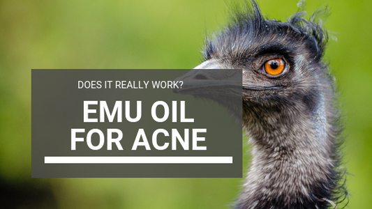 Emu Oil for Acne: Does It Really Work?