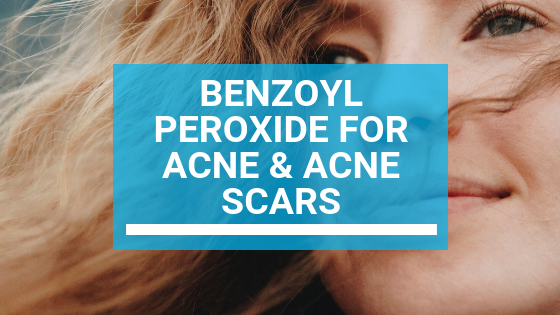 Benzoyl peroxide for acne scars deals