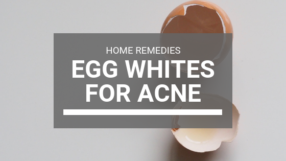 Egg Whites Mask for Acne: The Ultimate Home Remedy, Misumi – Misumi ...