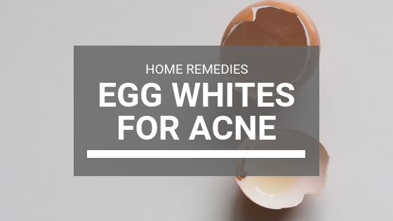 Egg Whites Mask for Acne: The Ultimate Home Remedy