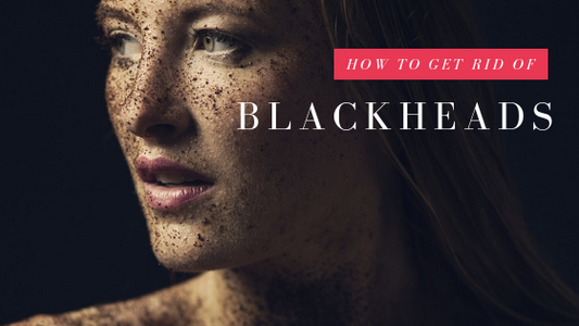 How to Get Rid of Blackheads