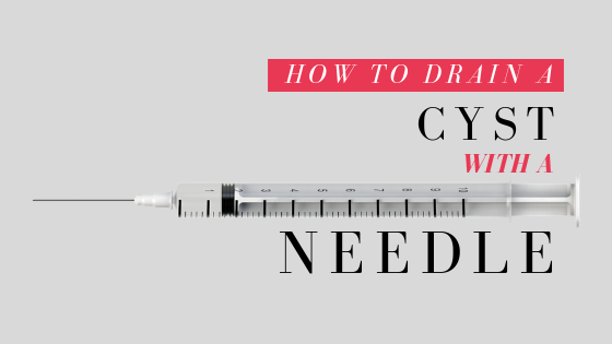 How To Drain A Cyst With A Needle