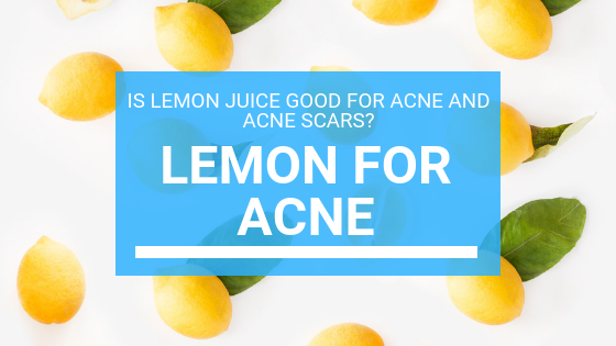 Lemon for Acne: Is Lemon Good For Acne and Acne Scars?