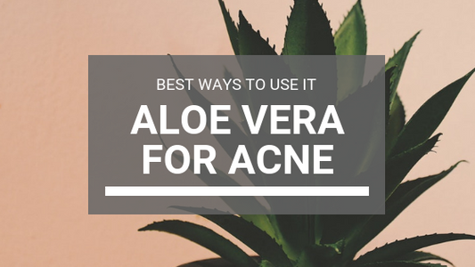 Aloe Vera For Acne: Best Ways To Use Aloe Vera To Get Rid Of Pimples