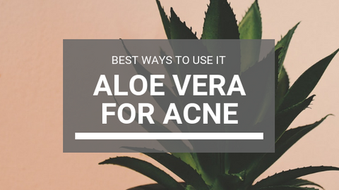 Aloe Vera For Acne: Best Ways To Use Aloe Vera To Get Rid Of Pimples ...