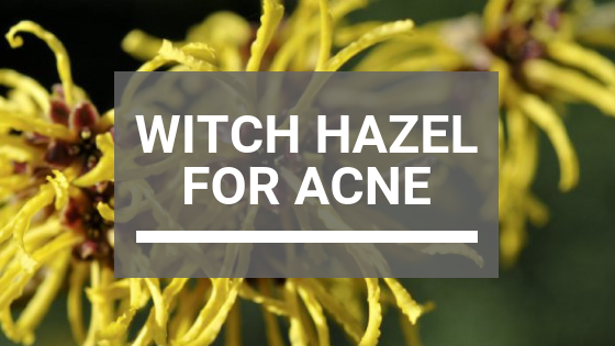 Is Witch Hazel Good for Acne?
