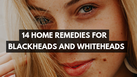 14 Home Remedies For Blackheads And Whiteheads - Misumi – Misumi Luxury ...