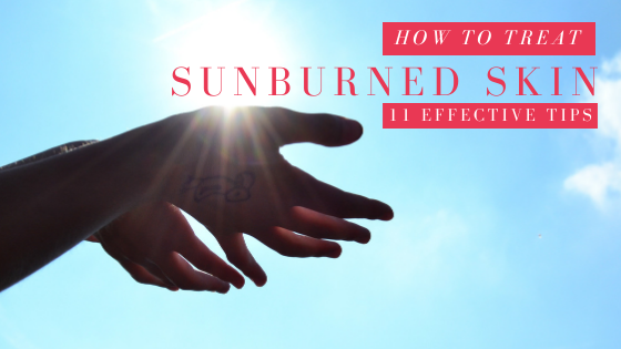 How to Treat a Sunburn at Home: 11 Effective Tips