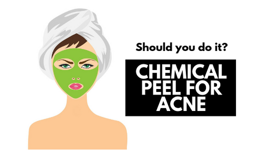 Chemical Peel for Acne