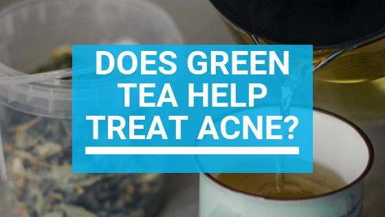 Green Tea For Acne: Does Green Tea Help Treat Acne?
