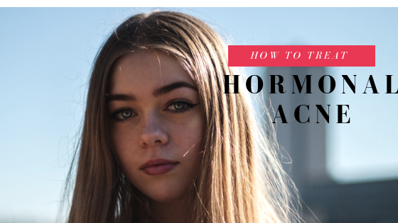 How To Deal With Hormonal Acne