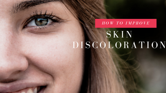 How to Get Rid of Skin Discoloration