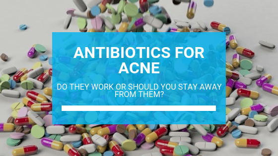 Antibiotics for Acne Treatment: Do They Work or Should You Stay Away from Them?