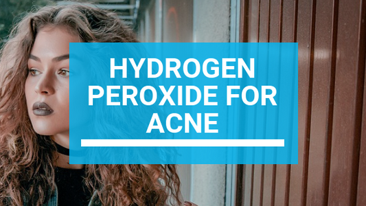 Hydrogen Peroxide for Acne