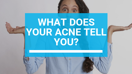 What Does Your Acne Tell You? Face Mapping Techniques