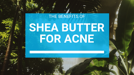 Shea Butter For Acne: Can Shea Butter Treat Acne?