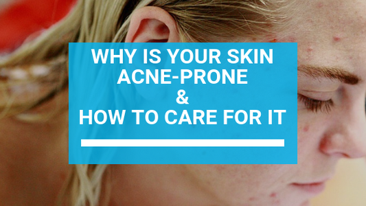 Why Is Your Skin Acne-Prone & How to Care for It