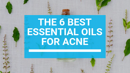 The 6 Best Essential Oils for Acne