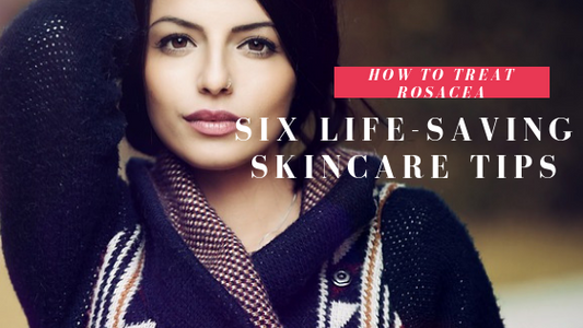 How to Treat Rosacea: Six Life-Saving Skincare Tips