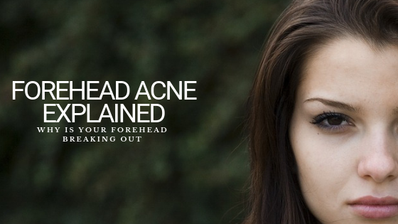 Why Is Your Forehead Breaking Out? Forehead Acne Explained