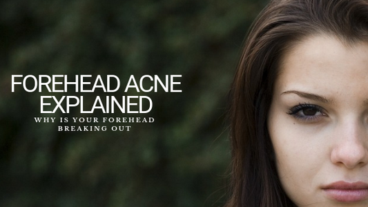 Why Is Your Forehead Breaking Out? Forehead Acne Explained