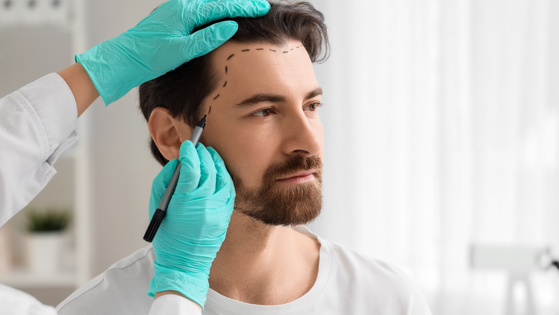 Is Hair Transplant Surgery the Long-Term Solution for You?