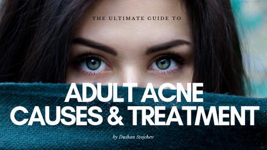 Adult Acne: Causes And Treatment