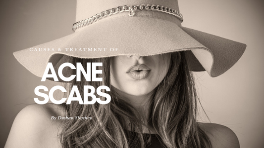 Acne Scabs: Causes and Treatment