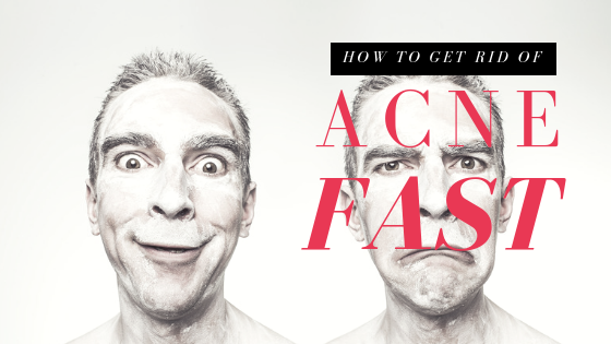 How To Get Rid Of Acne Fast