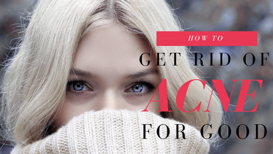 How To Get Rid Of Acne For Good