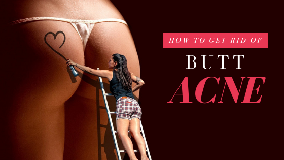 The Most Powerful Butt Acne Home Remedies