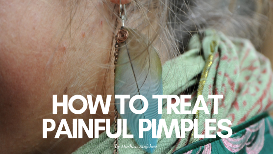 How To Treat Painful Pimples and Achieve Smooth Skin
