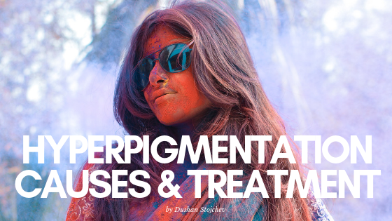Hyperpigmentation: Causes & Treatment