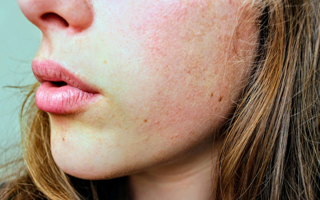 Can avoiding crowded indoor spaces help stop skin dehydration? What actually dries you out