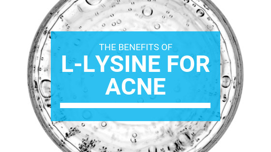 The Benefits of L-Lysine For Acne