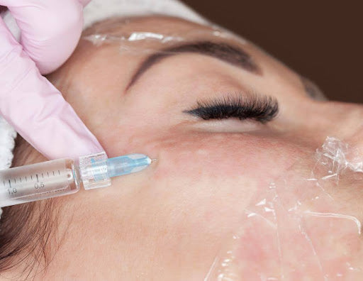 Why Botox Remains a Trusted Choice for Skin Rejuvenation