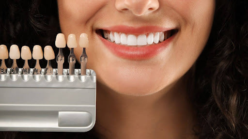 How Veneers and Teeth Whitening Differ for a Brighter Smile