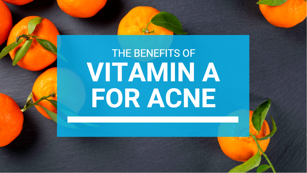 Vitamin A For Acne: The Ultimate Guide