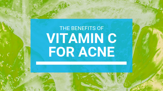 Using Vitamin C For Acne: the Ultimate Guide