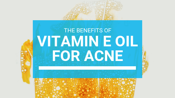 Vitamin E For Acne: The Ultimate Guide