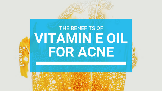 Vitamin E For Acne: The Ultimate Guide
