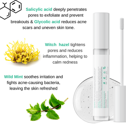 Acne Control Trio Kit